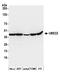 Ubiquitin Conjugating Enzyme E2 Z antibody, A304-983A, Bethyl Labs, Western Blot image 
