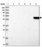 Solute Carrier Family 6 Member 11 antibody, PA5-58192, Invitrogen Antibodies, Western Blot image 