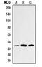 Sarcoglycan Alpha antibody, MBS821874, MyBioSource, Western Blot image 
