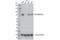 Histone-lysine N-methyltransferase MLL4 antibody, 63735S, Cell Signaling Technology, Western Blot image 