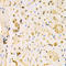 HERG antibody, LS-C332303, Lifespan Biosciences, Immunohistochemistry paraffin image 