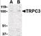 Transient Receptor Potential Cation Channel Subfamily C Member 3 antibody, orb86543, Biorbyt, Western Blot image 