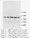 Mitochondrially Encoded Cytochrome C Oxidase I antibody, LS-C172112, Lifespan Biosciences, Western Blot image 