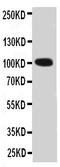 Coagulation Factor II, Thrombin antibody, PA2058, Boster Biological Technology, Western Blot image 