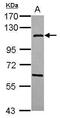 N-Acetyltransferase 10 antibody, PA5-31377, Invitrogen Antibodies, Western Blot image 