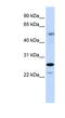 Homologous-pairing protein 2 homolog antibody, NBP1-79238, Novus Biologicals, Western Blot image 