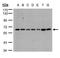 Cytochrome P450 Family 24 Subfamily A Member 1 antibody, TA308204, Origene, Western Blot image 