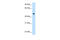 Complement component C8 beta chain antibody, 29-966, ProSci, Western Blot image 