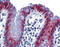 hAG-2 antibody, ARP42290_P050, Aviva Systems Biology, Immunohistochemistry paraffin image 