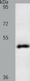 Spermatogenesis Associated 17 antibody, TA322067, Origene, Western Blot image 