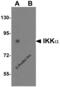 Inhibitor of nuclear factor kappa-B kinase subunit alpha antibody, 2115, ProSci Inc, Western Blot image 