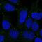 Major Facilitator Superfamily Domain Containing 3 antibody, PA5-63237, Invitrogen Antibodies, Immunofluorescence image 