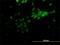 Nuclear receptor subfamily 2 group E member 1 antibody, H00007101-M06, Novus Biologicals, Immunofluorescence image 