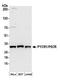 Pyrroline-5-Carboxylate Reductase 1 antibody, A304-836A, Bethyl Labs, Western Blot image 