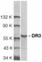 TNF Receptor Superfamily Member 25 antibody, AHP435, Bio-Rad (formerly AbD Serotec) , Western Blot image 