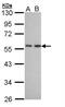 Dipeptidyl Peptidase 7 antibody, NBP1-32875, Novus Biologicals, Western Blot image 