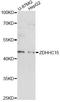 Zinc Finger DHHC-Type Containing 15 antibody, LS-C749454, Lifespan Biosciences, Western Blot image 