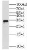 Endonuclease III-like protein 1 antibody, FNab05884, FineTest, Western Blot image 