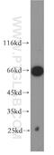 TATA-Box Binding Protein Associated Factor 5 Like antibody, 19274-1-AP, Proteintech Group, Western Blot image 