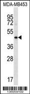 Hyaluronan And Proteoglycan Link Protein 3 antibody, 58-660, ProSci, Western Blot image 