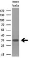 Hematopoietically-expressed homeobox protein HHEX antibody, M02723, Boster Biological Technology, Western Blot image 