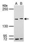 SET Domain Containing 2, Histone Lysine Methyltransferase antibody, PA5-34934, Invitrogen Antibodies, Western Blot image 