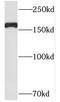 Pre-mRNA cleavage complex 2 protein Pcf11 antibody, FNab06207, FineTest, Western Blot image 