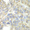 Delta-1-pyrroline-5-carboxylate dehydrogenase, mitochondrial antibody, LS-C335256, Lifespan Biosciences, Immunohistochemistry paraffin image 