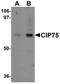Ubiquilin-4 antibody, NBP1-77054, Novus Biologicals, Western Blot image 