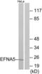 Ephrin A5 antibody, LS-B7057, Lifespan Biosciences, Western Blot image 