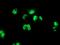 PBX Homeobox 1 antibody, MA5-25580, Invitrogen Antibodies, Immunocytochemistry image 