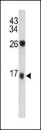 Dermcidin antibody, LS-C167290, Lifespan Biosciences, Western Blot image 