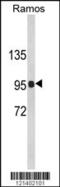 Complement C3d Receptor 2 antibody, 62-563, ProSci, Western Blot image 
