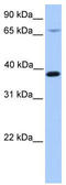Hydroxymethylbilane Synthase antibody, TA334951, Origene, Western Blot image 