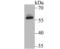 H/ACA ribonucleoprotein complex subunit 4 antibody, NBP2-75472, Novus Biologicals, Western Blot image 