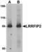 Leucine-rich repeat flightless-interacting protein 2 antibody, LS-C144340, Lifespan Biosciences, Western Blot image 