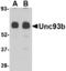Unc-93B1 antibody, TA306557, Origene, Western Blot image 