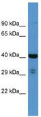 Secretory Carrier Membrane Protein 3 antibody, TA342621, Origene, Western Blot image 