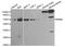 Golgi Associated, Gamma Adaptin Ear Containing, ARF Binding Protein 2 antibody, MBS127223, MyBioSource, Western Blot image 