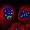 Ribosomal RNA Processing 1B antibody, HPA017893, Atlas Antibodies, Immunofluorescence image 