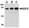 p75 ICD antibody, TA306246, Origene, Western Blot image 