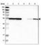 Heterogeneous nuclear ribonucleoprotein H2 antibody, NBP1-89816, Novus Biologicals, Western Blot image 