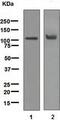 Androgen Receptor antibody, ab108341, Abcam, Western Blot image 