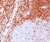 BCL2 antibody, V2007IHC-7ML, NSJ Bioreagents, Immunohistochemistry paraffin image 