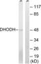 Dihydroorotate Dehydrogenase (Quinone) antibody, LS-C198880, Lifespan Biosciences, Western Blot image 
