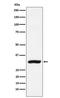 Carbonyl Reductase 1 antibody, M02825-2, Boster Biological Technology, Western Blot image 