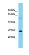 Ubiquitin C-Terminal Hydrolase L1 antibody, orb331032, Biorbyt, Western Blot image 