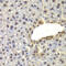 SPT20 Homolog, SAGA Complex Component antibody, 22-898, ProSci, Immunohistochemistry paraffin image 