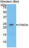 Fc-gamma RIII antibody, MBS2013505, MyBioSource, Western Blot image 