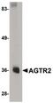 AGTR2 antibody, PA5-20813, Invitrogen Antibodies, Western Blot image 